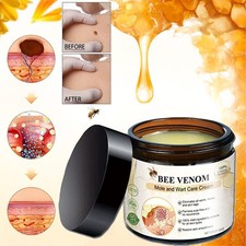 Bee Venom Skin Tag Removal Treatment Cream Body Care Mole Corn Wart Remover 60g
