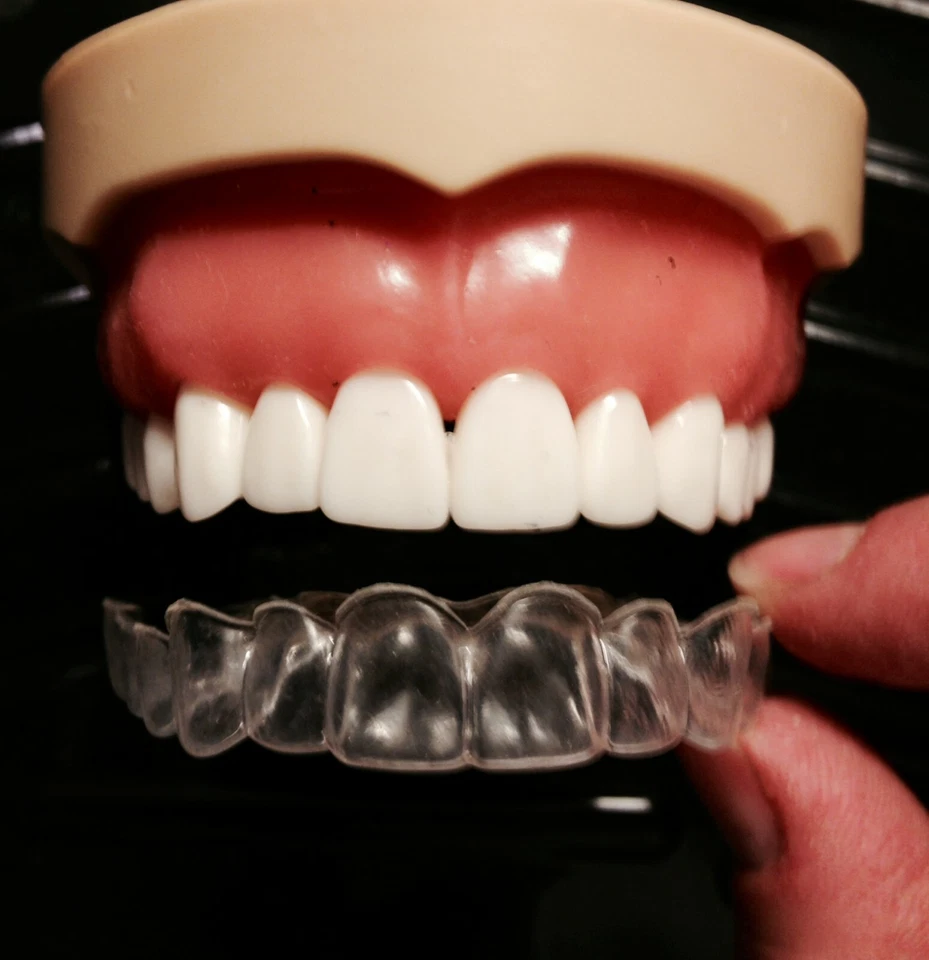 Custom Dental Retainer Set - THICKER -1.5mm - Double layered- USA Dental Lab - Image 2 of 4
