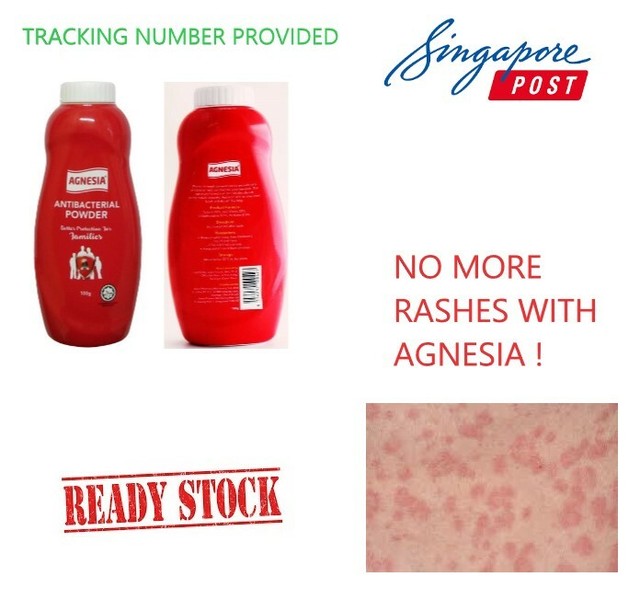 agnesia powder for baby rashes