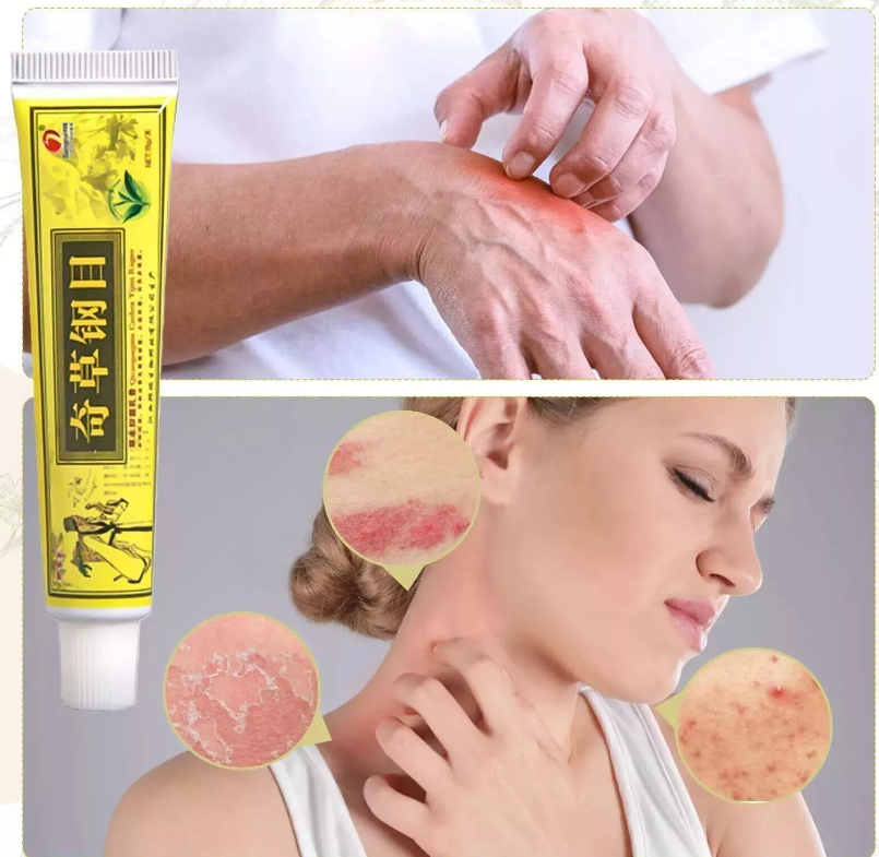 6Pcs Skin Care Cream Natural Organic Herbal Skin Cream Healing Cream eBay