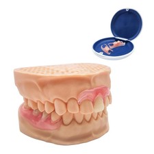 Custom Partial Dentures Personalized Removable Denture Set for Missing T
