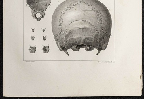 1864 - OS Occipital Kind und Hase - Surfboard Anatomie - Lithografie Léveillé - Bild 3 von 3