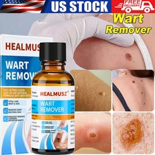 Wart Remover Liquid Foot Corn Wart Remove Liquid Skin Tag Mole Remover Eliminate