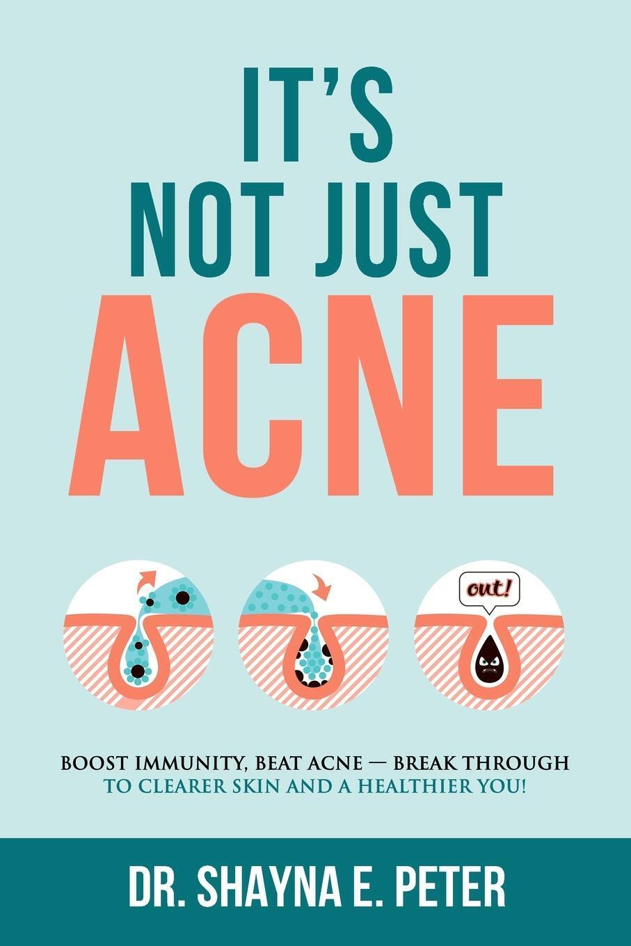 Thumbnail - Shayna E Peter | It's Not Just Acne | Taschenbuch | Englisch (2020) |