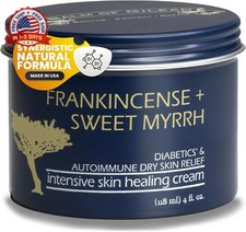 BALM OF GILEAD Foot Healing Cream - Frankincense & Sweet Myrrh Moisturizer for S