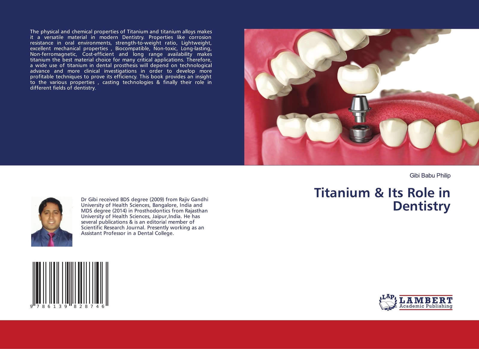 Thumbnail - Gibi Babu Philip | Titanium & Its Role In Dentistry | Taschenbuch |