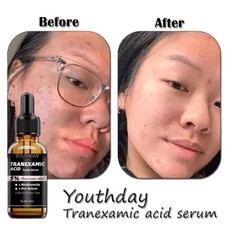 100 Tranexamic Acid Serum 1 fl oz/30ml