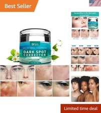 Natural Dark Spot Remover Cream - Hyperpigmentation Treatment for All Skin Types