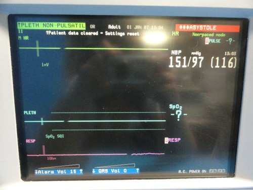 HP V24CT Critical Care Patient Monitoring System W/ NBP EKG & SpO2 Leads ~14572 - Picture 3 of 12