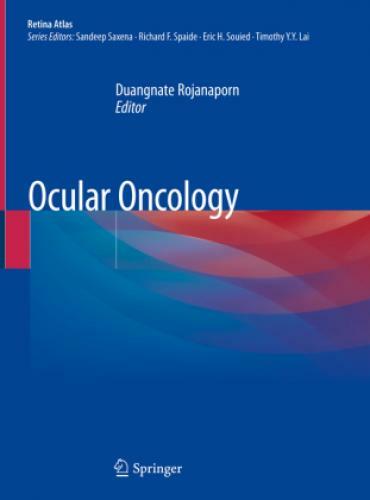 Thumbnail - Ocular Oncology 5314
