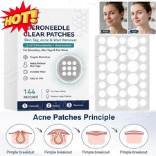 Curalona Microneedle Patches 144pcs, Skin Tag Wart Acne Remover Patches 20 OFF