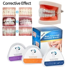 Adults Dental Orthodontic Teeth Corrector Braces Tooth Retainer Box Straighten