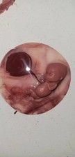 12 week gestational fetus silicone memorial silicone womb with placenta attached