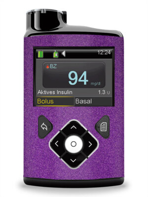 Aufkleber Sticker für Medtronic Minimed Insulinpumpe     Violett Metallic