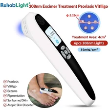 308nm Light Therapy Portable Narrowband Device Ultraviolet Skin Therapy For Skin