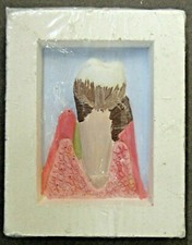 vintage #5 McKesson Robbins DISPLAY TOOTH Dentist study aid dental dentistry z5