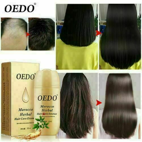 esencia rica en vitaminas Para El Cabello Tratamiento Para