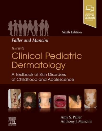 Paller and Mancini - Hurwitz Clinical Pediatric Dermatology Paller Mancini 6e