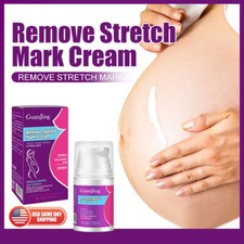Maternity Scar Stretch Mark Prevention Remover Cream Hypoallergenic Paraben Free