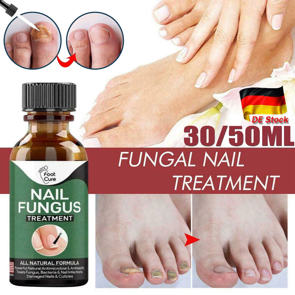 A.nailfix Antifungal Antihongos 30gr Uña Amarilla Yellow Nails Treatment  for sale online | eBay