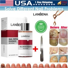 LANBENA Fungal Nail Repair Essence Serum Care Finger Toe Anti Nail Repair Liquid