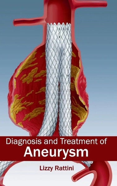 Lizzy Rattini | Diagnosis And Treatment Of Aneurysm | Buch | Englisch (2015)-image