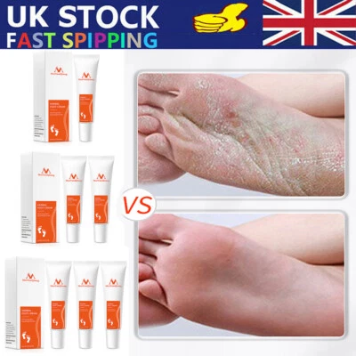 TZUTOGETHER 15g Foot Cream Anti Fungal Infection Fungus Gel Repair Dry Crack Toe Treatment