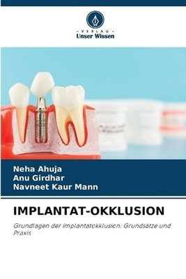 Implantat-Okklusion by Neha Ahuja (German) Paperback Book