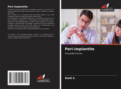 Rohit S. | Peri-implantite | Taschenbuch | Italienisch (2021)