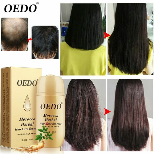 Tratamiento Para El Cabello Seco Luce Un Cabello Saludable De Manera  NATURAL | eBay