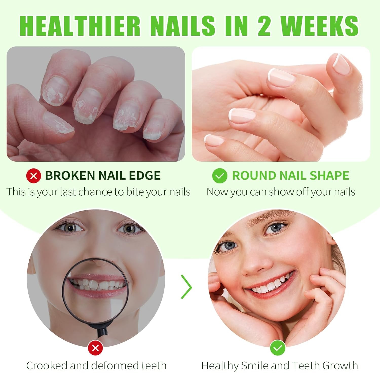 Nail Biting Treatment for Kids, Thumb Sucking Deterrent, Biting... 