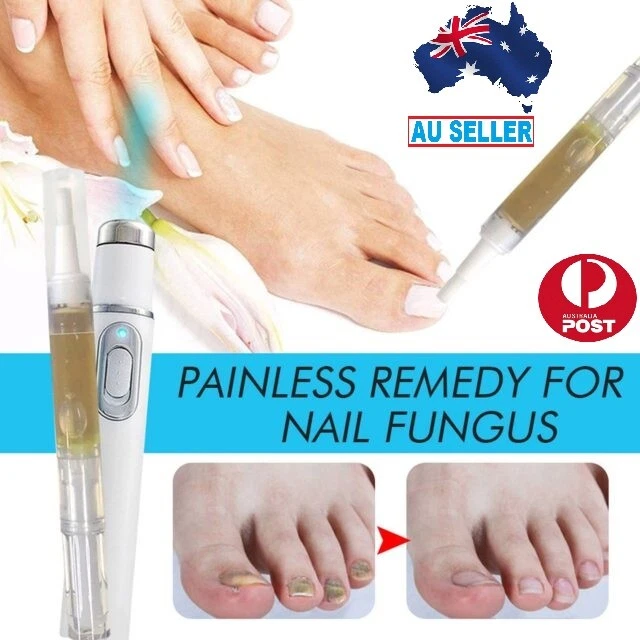 Top more than 140 antifungal nail treatment australia best ceg.edu.vn