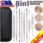 8pcs Pimple Popper Extractor Remover Face Blackhead Acne Clip Needle NEW