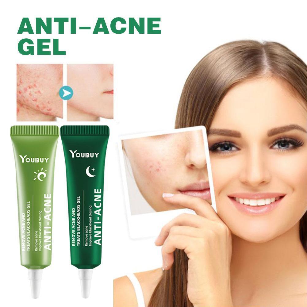 Youbuy Anti-acne Gel Diminish Acne Scars Gently Soothe Youbuy Anti-acne Gel Diminish Acne Scars Gently Soothe