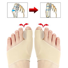 Toe Separator Hallux Valgus Bunion Corrector Orthotics Feet Bone Thumb Adjuster
