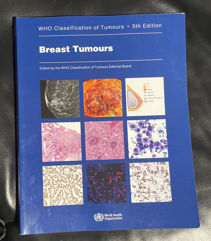 The WHO Classification oF Tomours - 5th Edition Breast The WHO Classification oF Tomours - 5th Edition Breast