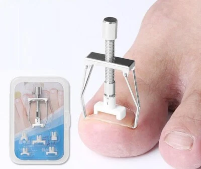 Effective Ingrown Onyxis Toe Nail Corrector Straightener Foot Treatment Tool