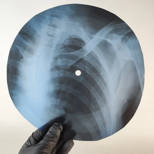 LED ZEPPELIN THATS THE WAY X-Ray USSR Record Roentgen Bone Ribs Music Vinyl