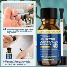 Fast-Acting Wart Removal Kit with Salicylic Acid for Safe Skin Care