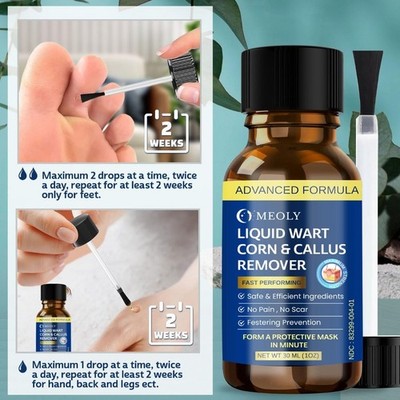 Fast-Acting Wart Removal Kit with Salicylic Acid for Safe Skin Care