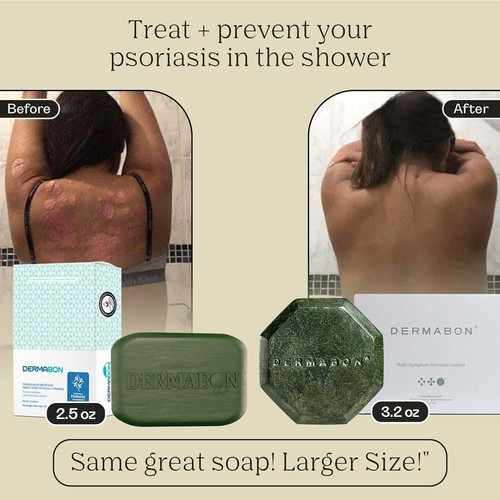 Saponetta Sollievo Intensivo per Psoriasi ed Eczema - Confezione da 3, Formula Idratante - Foto 8 di 8