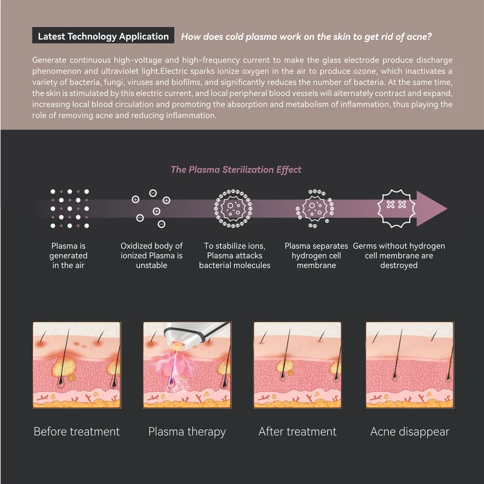 Mjolnir Lite Cold Plasma Acne Removal Device  Painless Treatment No Side Effects - Image 4 of 4