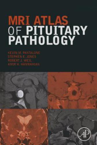 MRI Atlas of Pituitary Pathology Pantalone Jones Weil Hamrahian Hardback