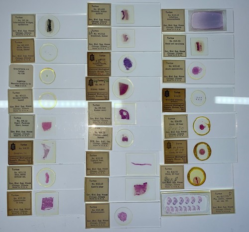 TURTOX Microscope Slide Set HUMAN Histology PATHOLOGY Embryology ORGAN SYSTEMS - Picture 2 of 9