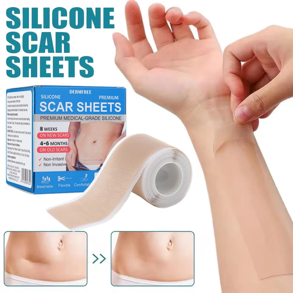 Collagen Scar Tape Scar Sheets Tape Roll Silicone Scar Tape For Delicate Skin UK - Image 4 of 4