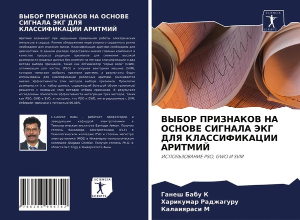 Vybor Priznakov NA Osnove Signala Jekg Dlya Klassifikacii Aritmij K (U. A.) Buch-image