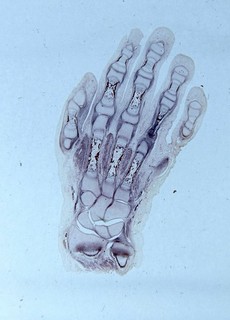 Vintage microscope slide from Guy's Hospital. "Entire hand of Human Embryo".