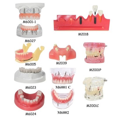 Dental Implant Training Model Upper / Lower Jaw with Overdenture Demo & Base