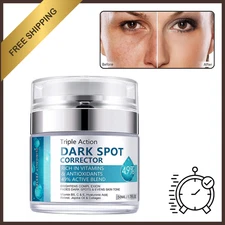 Dark Spot Remover Cream for Face Body Age Spots Melasma Freckles Women Men US