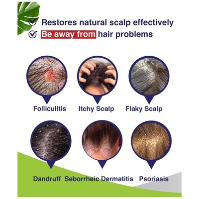 Scalp Psoriasis Treatment Shampoo - Soothing Formula/-
